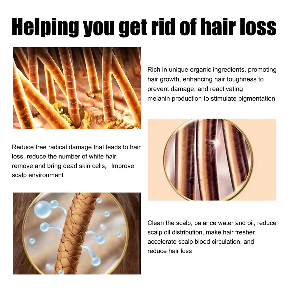 Helping you get rid of hair loss