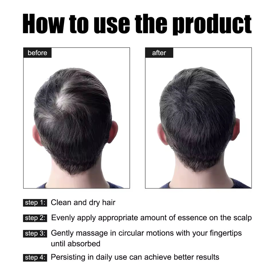 How to use East Moon Hair Essence Oil — before and after 4 steps
